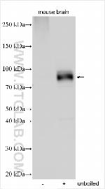 SLC2A13 Antibody in Western Blot (WB)