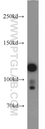 NCAM2 Antibody in Western Blot (WB)