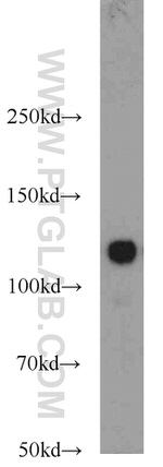 NCAM2 Antibody in Western Blot (WB)