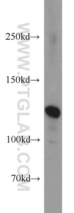 NCAM2 Antibody in Western Blot (WB)