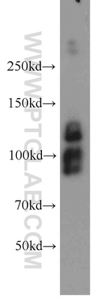 CYTSB Antibody in Western Blot (WB)