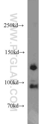 CYTSB Antibody in Western Blot (WB)