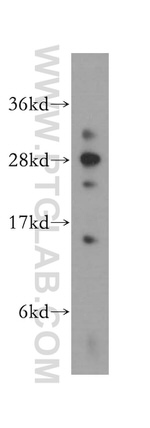 DNAJC4 Antibody in Western Blot (WB)