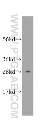 DNAJC4 Antibody in Western Blot (WB)