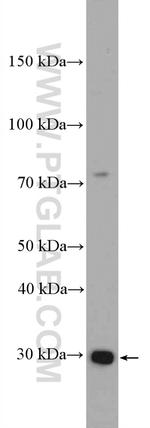 DNAJC4 Antibody in Western Blot (WB)