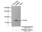 SORBS1 Antibody in Immunoprecipitation (IP)