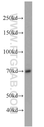 SORBS1 Antibody in Western Blot (WB)