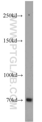 SORBS1 Antibody in Western Blot (WB)