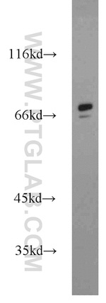 SORBS1 Antibody in Western Blot (WB)