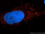 TIMM44 Antibody in Immunocytochemistry (ICC/IF)