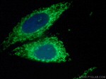 TIMM44 Antibody in Immunocytochemistry (ICC/IF)