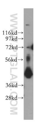 TIMM44 Antibody in Western Blot (WB)