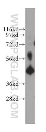 TIMM44 Antibody in Western Blot (WB)