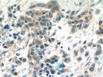 AEG-1/MTDH Antibody in Immunohistochemistry (Paraffin) (IHC (P))
