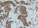 AEG-1/MTDH Antibody in Immunohistochemistry (Paraffin) (IHC (P))