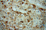CCPG1 Antibody in Immunohistochemistry (Paraffin) (IHC (P))