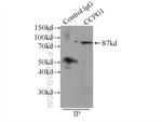 CCPG1 Antibody in Immunoprecipitation (IP)