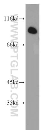 CCPG1 Antibody in Western Blot (WB)