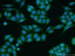 TACC1 Antibody in Immunocytochemistry (ICC/IF)
