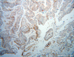 DCP1B Antibody in Immunohistochemistry (Paraffin) (IHC (P))