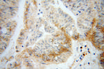 DCP1B Antibody in Immunohistochemistry (Paraffin) (IHC (P))