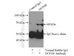 DCP1B Antibody in Immunoprecipitation (IP)