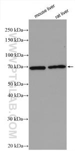 DCP1B Antibody in Western Blot (WB)