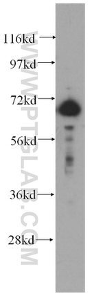 DCP1B Antibody in Western Blot (WB)