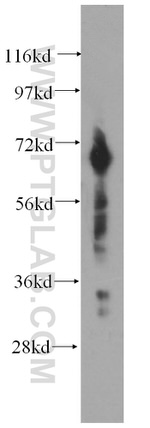 DCP1B Antibody in Western Blot (WB)