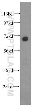 DCP1B Antibody in Western Blot (WB)