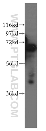 DCP1B Antibody in Western Blot (WB)