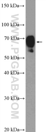 DCP1B Antibody in Western Blot (WB)