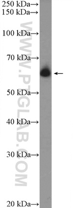 DCP1B Antibody in Western Blot (WB)