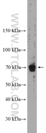 Frizzled 9 Antibody in Western Blot (WB)