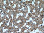 VPS41 Antibody in Immunohistochemistry (Paraffin) (IHC (P))