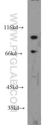 VPS41 Antibody in Western Blot (WB)