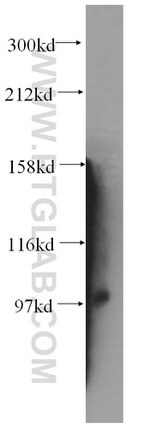 VPS41 Antibody in Western Blot (WB)