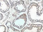DGKH Antibody in Immunohistochemistry (Paraffin) (IHC (P))