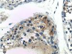 DGKH Antibody in Immunohistochemistry (Paraffin) (IHC (P))