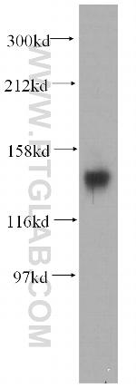 DGKH Antibody in Western Blot (WB)