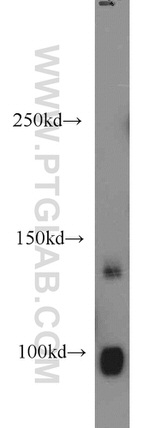 DGKH Antibody in Western Blot (WB)