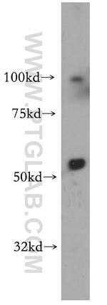 S1PR5/EDG8 Antibody in Western Blot (WB)