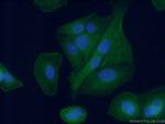 Aggrecan Antibody in Immunocytochemistry (ICC/IF)