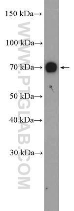 Aggrecan Antibody in Western Blot (WB)