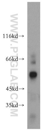 SIAH1 Antibody in Western Blot (WB)