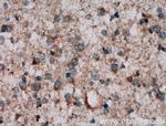 NKIAMRE Antibody in Immunohistochemistry (Paraffin) (IHC (P))