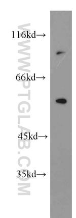 NKIAMRE Antibody in Western Blot (WB)