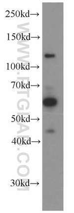 NKIAMRE Antibody in Western Blot (WB)