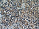 GREM2 Antibody in Immunohistochemistry (Paraffin) (IHC (P))