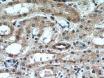 GREM2 Antibody in Immunohistochemistry (Paraffin) (IHC (P))